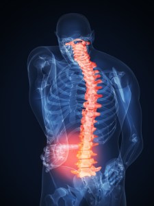low_back_pain_management